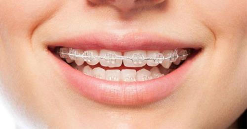 روش های زیباشناسی دندان